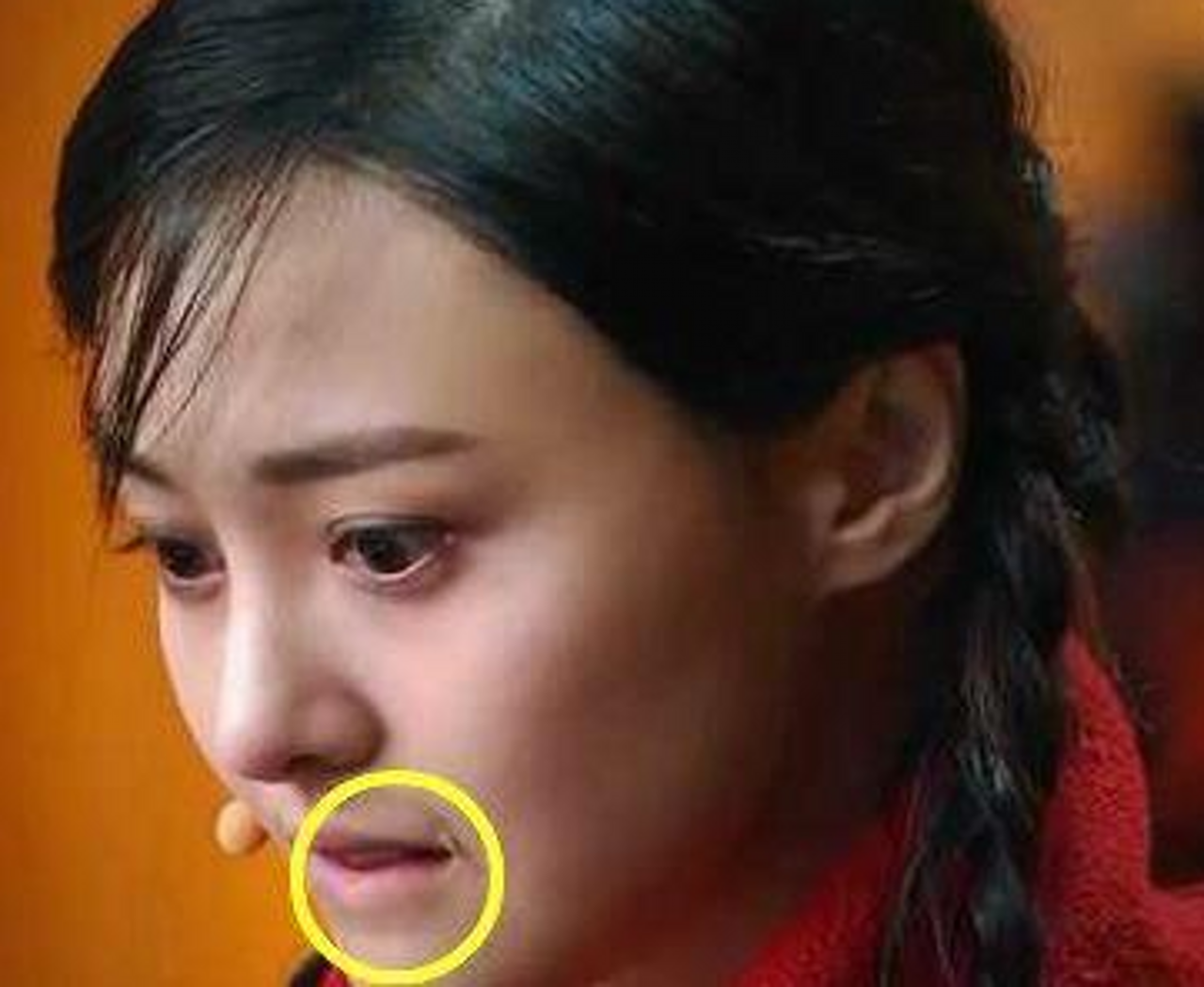 明星脸上的疤痕，独特之美与坚韧力量的象征